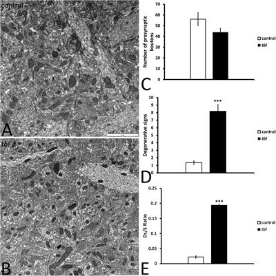 HERC1 Ubiquitin Ligase Is Required for Hippocampal Learning and Memory